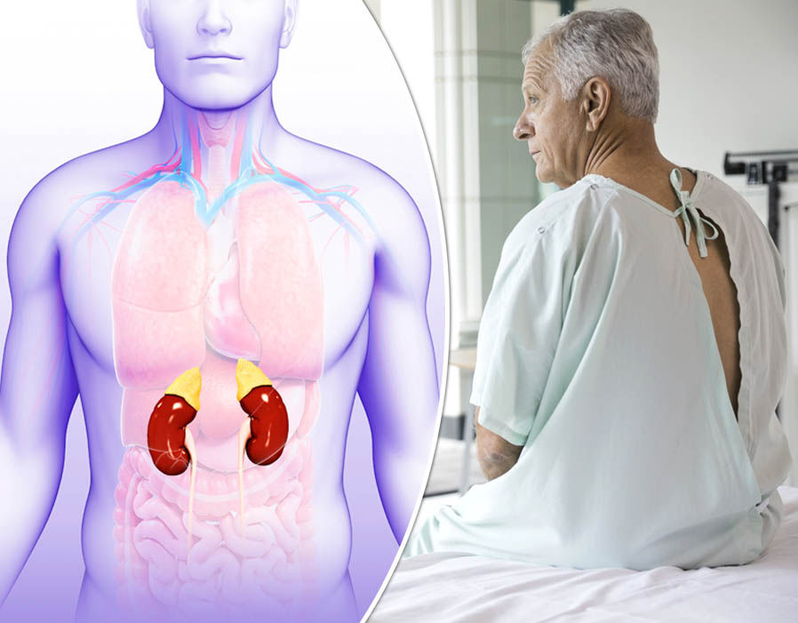 Addison Hastalığının Belirtileri Nelerdir?